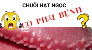 Chuỗi hạt ngọc quy đầu là gì? có phải là bệnh & có cần điều trị không?